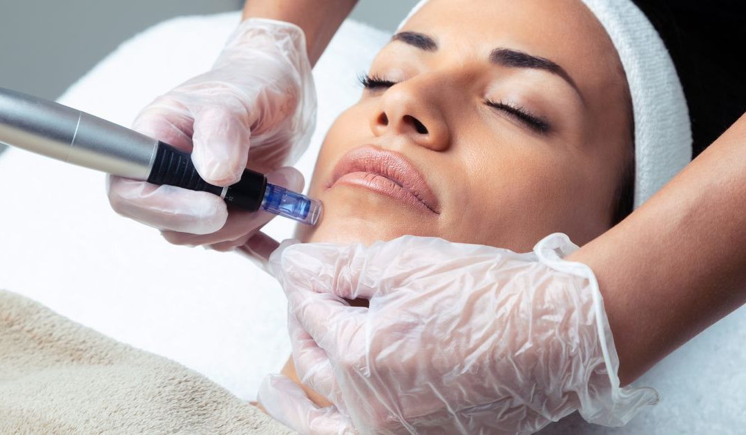 tratamiento facial dermapen barcelona lemon