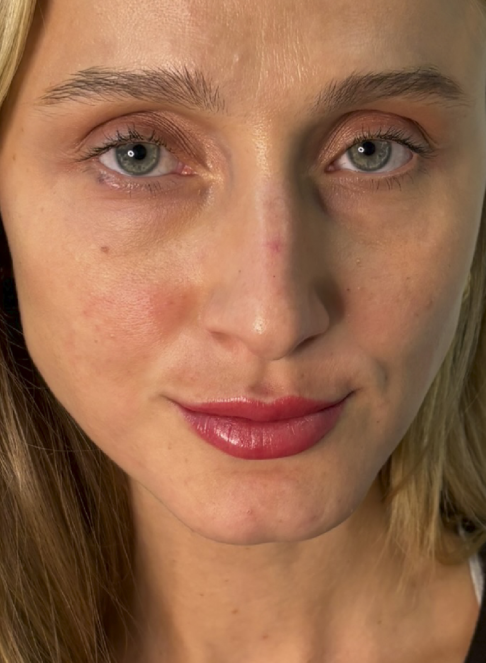 Foto Antes y después tratamiento Micropigmentación de labios natural - Maquillaje permanente)