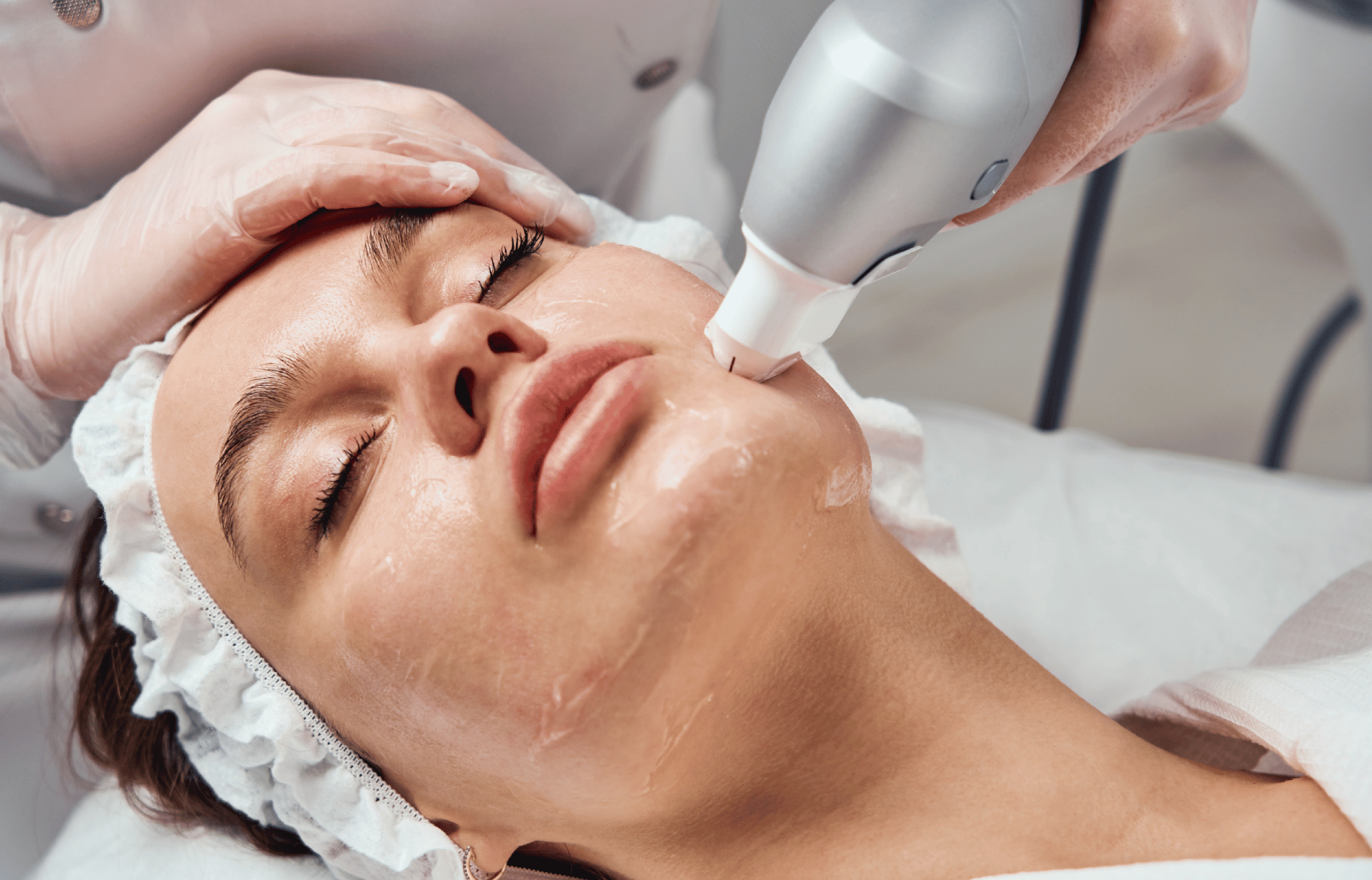 Foto tratamiento HIFU Ultraformer - Lifting facial sin cirugía