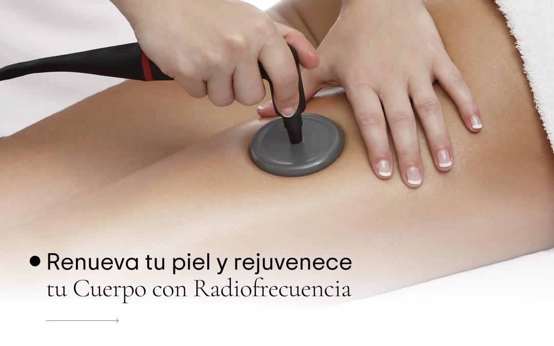 Radiofreqüència