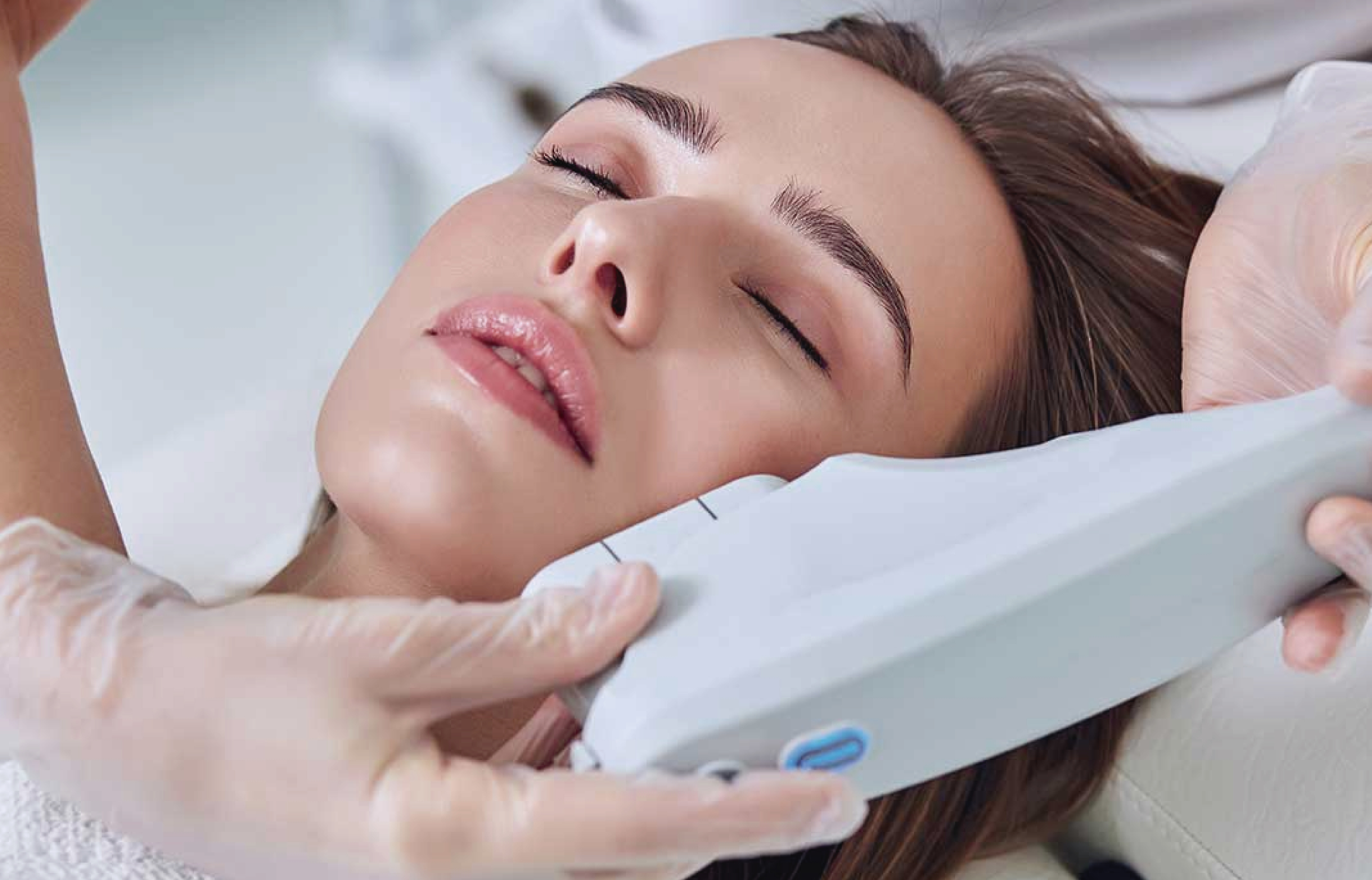 Foto tratamiento HIFU - Lifting facial sin cirugía