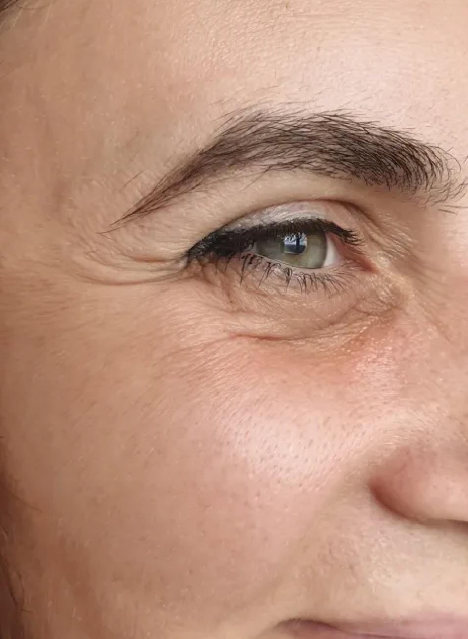 Foto Antes y después tratamiento Armonización Facial: Realza tu belleza con resultados naturales