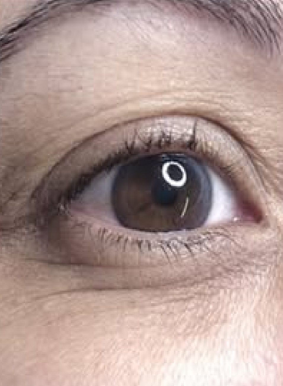 Foto Antes y después tratamiento Micropigmentación de ojos natural - Maquillaje permanente)